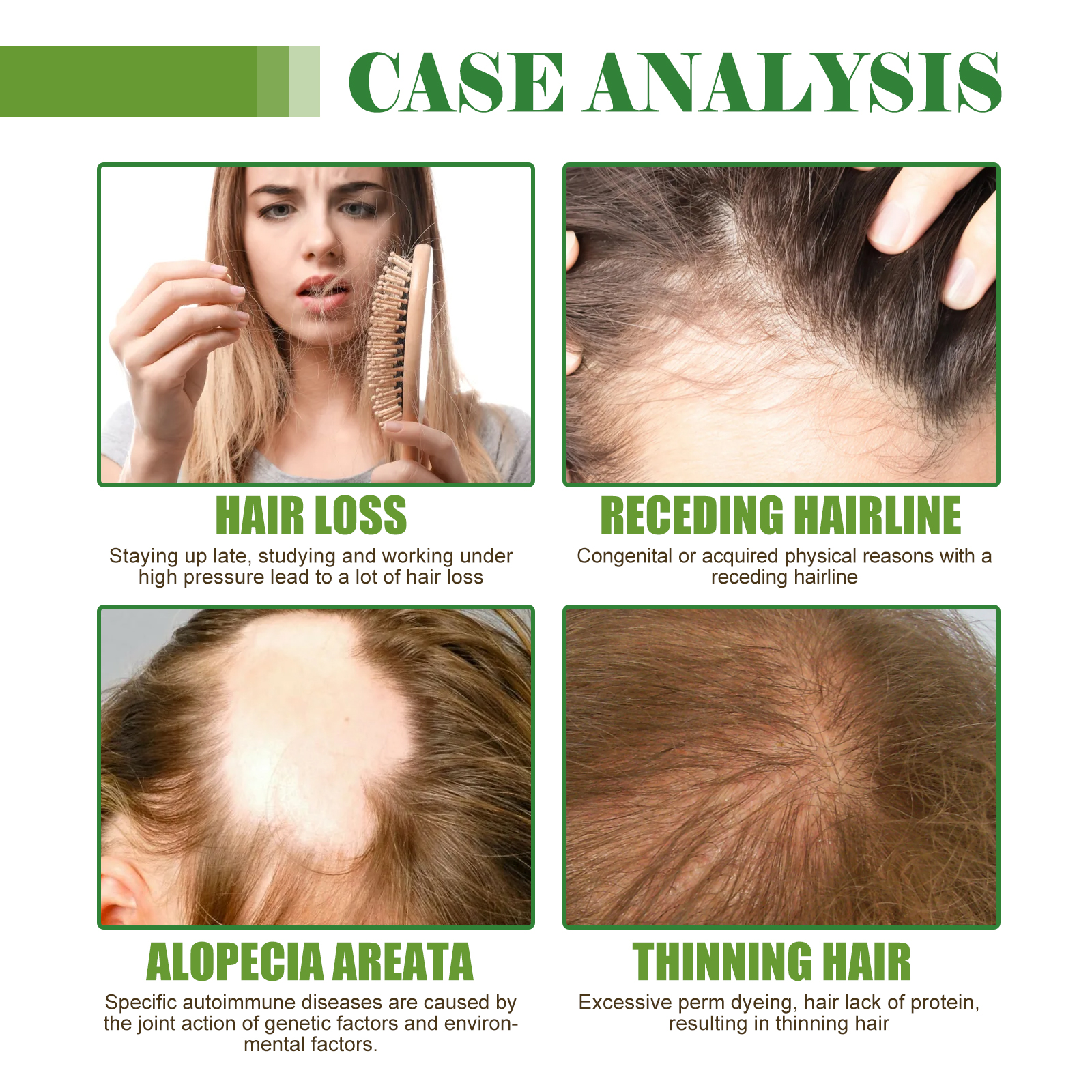 Hair Care Essential Oil Moisturizes And Protects Dry Hair, Moisturizes And Softens Hair Care Essential Oil - Image 5